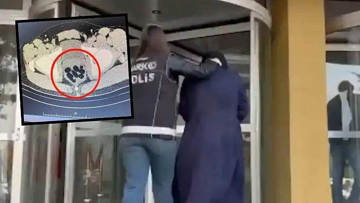 Kayseri'de midesinde 500 gram uyuşturucu taşıyan şahıs yakalandı!