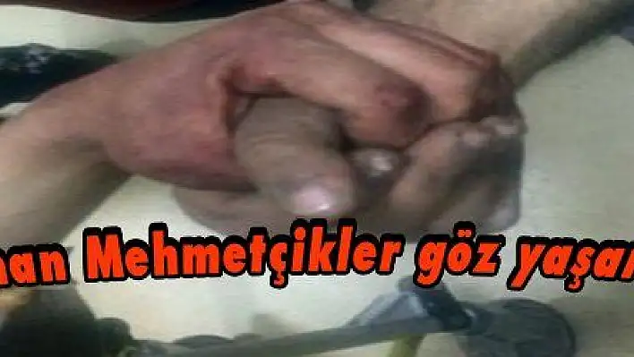 Yaralı kahraman Mehmetçikler göz yaşarttı, ders verdi