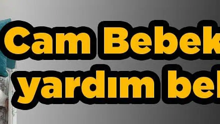 Cam Bebek Kadir yardım bekliyor!