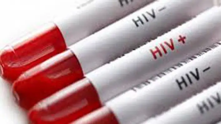 Benli: 'HIV en fazla 25-49 yaş arasını etkiliyor' 