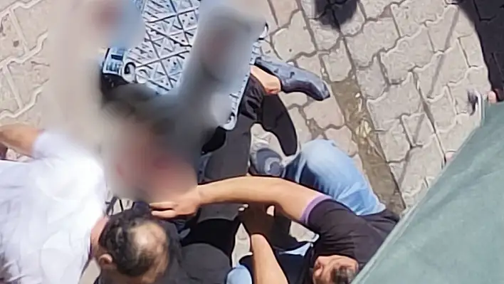 Melikgazi'de kanlı kavga: Bir kişi ayağından yaralandı!