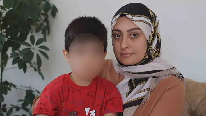 Nevşehir'de ameliyat olan çocuğun ağzında yanık oluştu!