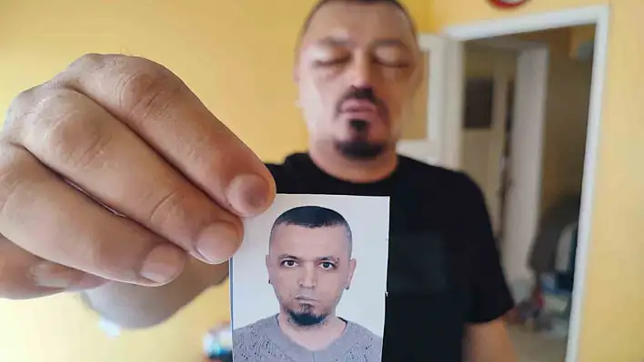 Adana'da kullandığı şampuan hayatını kararttı!