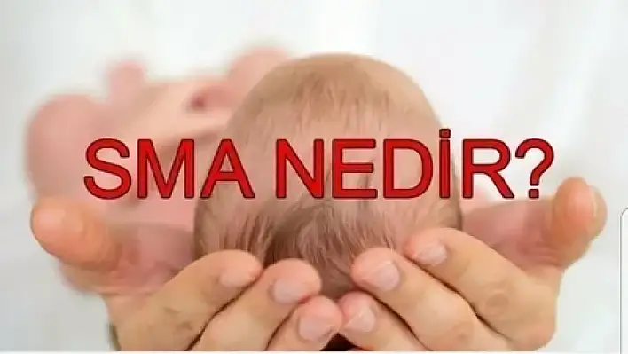 SMA hastalığı nedir ? Nasıl ortaya çıkar