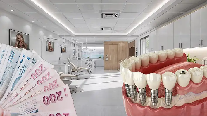 TBMM'ye sunuldu: İmplant tedavileri artık ücretsiz mi olacak?