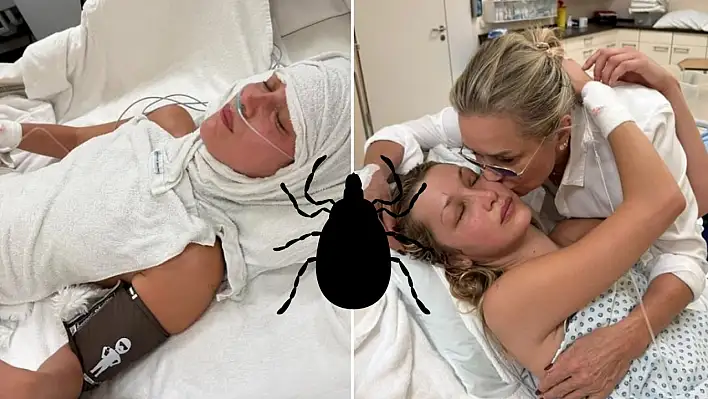 Ünlü model Bella Hadid'in hastalığı Lyme nedir?