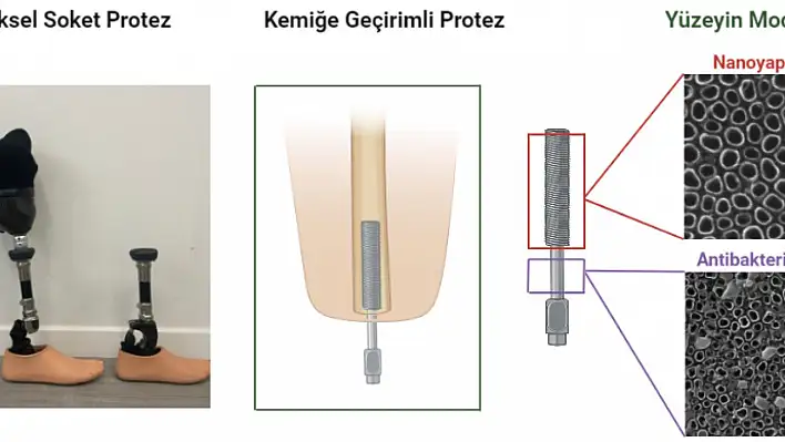 Uzuv kayıplarına karşı protez teknolojisi