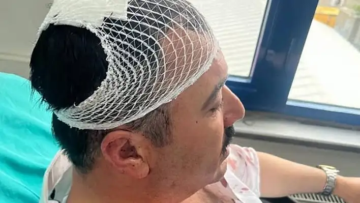 Yeniden Refah Partisi'nde kavga - O ismi şekerlikle yaraladı