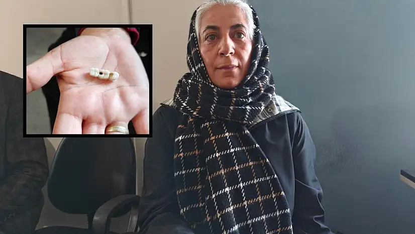 Kayseri'de implant elinde hasta şikayette