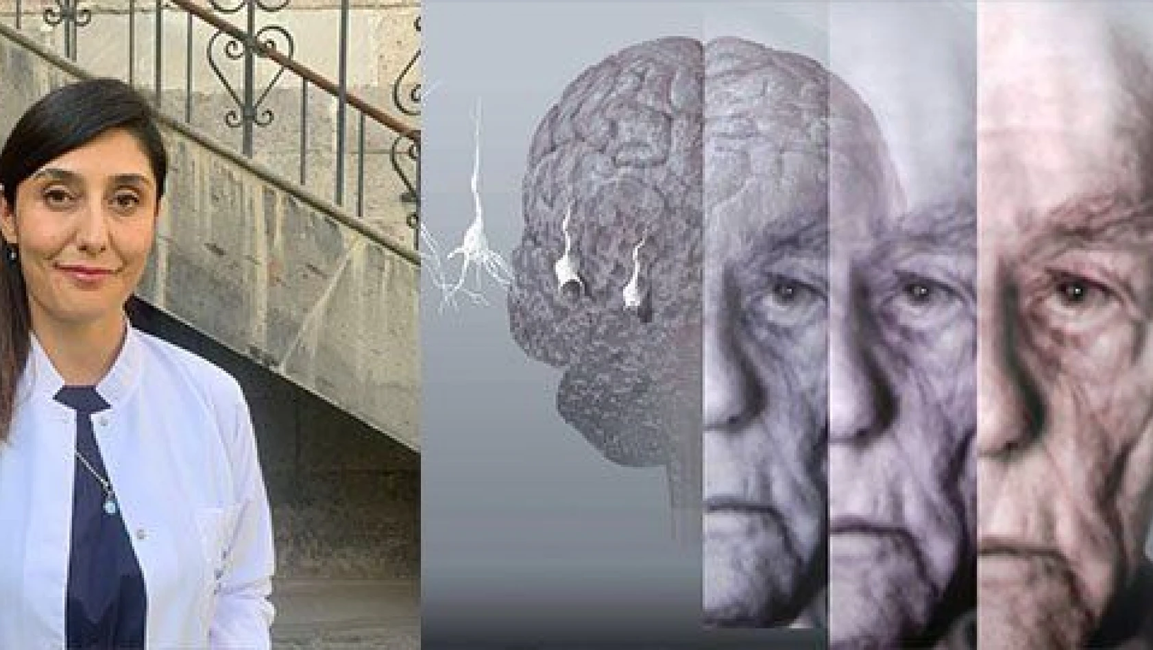  Alzheimerın düşmanı 'egzersiz'