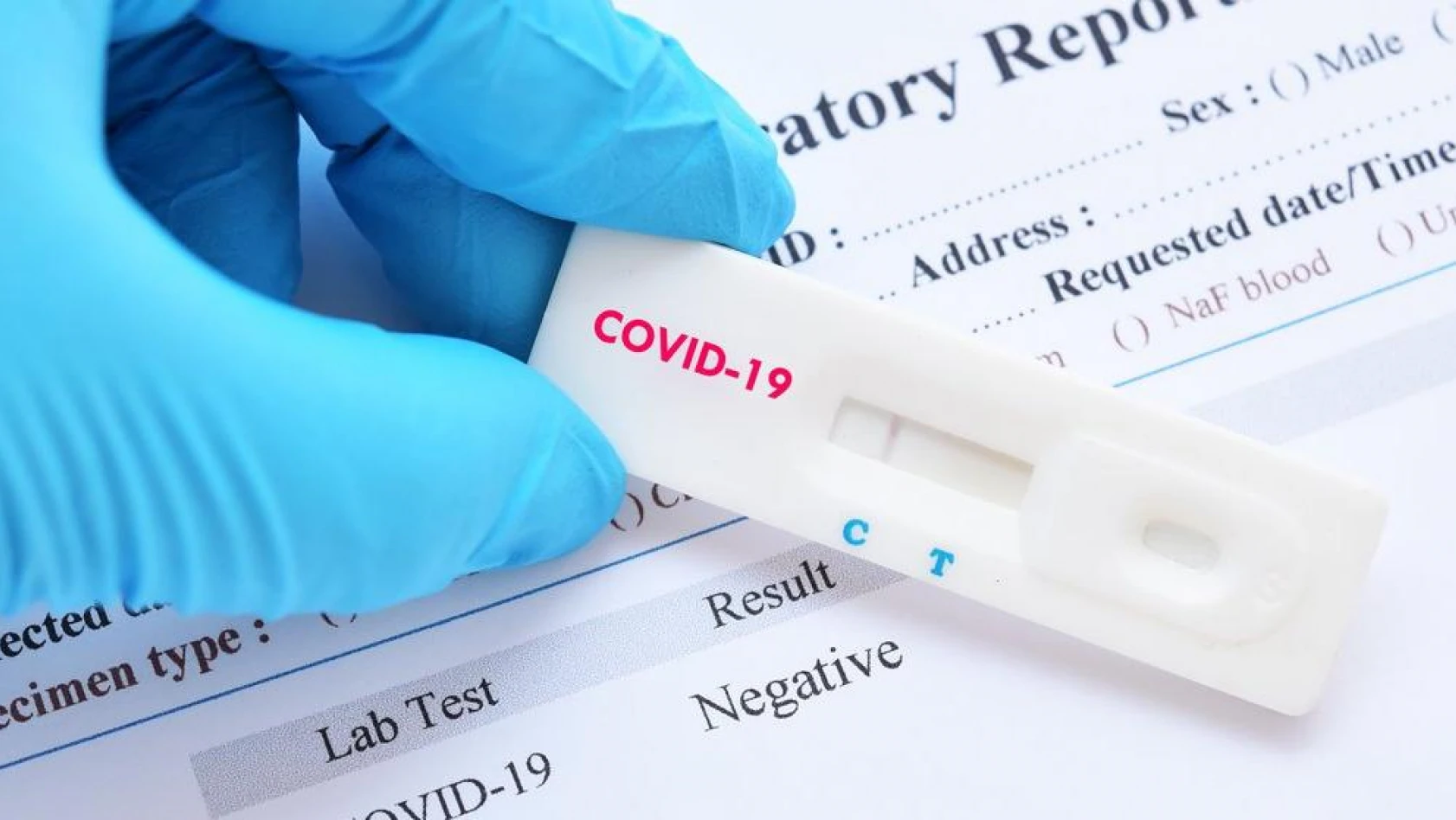 ABD'de 5 dakikada sonuç veren 'koronavirüs test kiti' geliştirildi