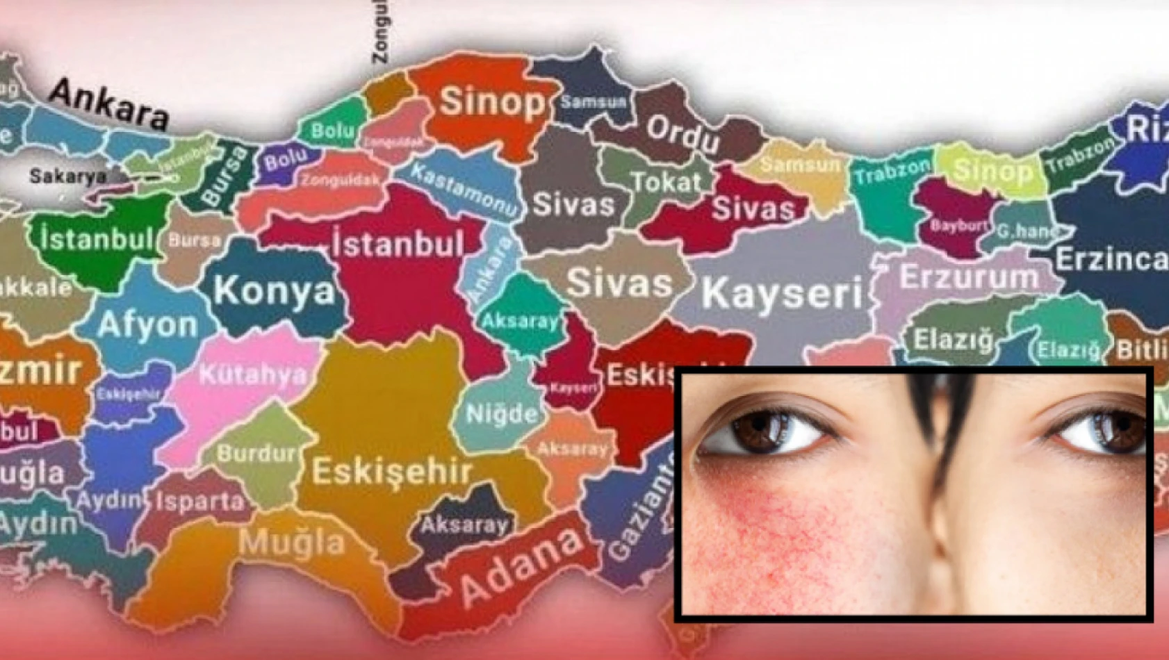 Kayseri, Bolu, Nevşehir, Niğde, Karabük, Çankırı dikkat - Cildiniz zarar görebilir!