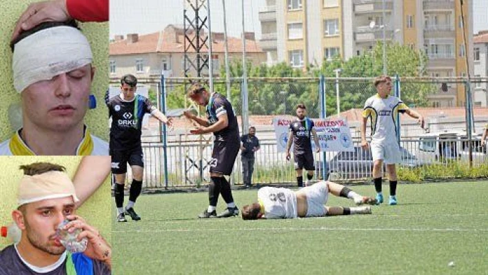 2 futbolcu kafa kafaya çarpıştı. Kanlar içerisinde kaldılar